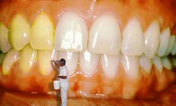 Perfect Smile Whitening